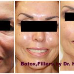 Botox Rockville
