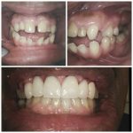 before and after dentist rockville
