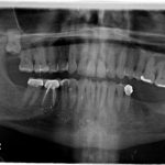Dental XRays Rockville