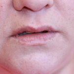 Fillers Rockville