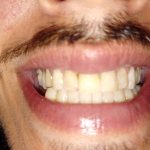 smile dentist rockville