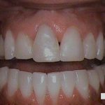 teeth dentist rockville