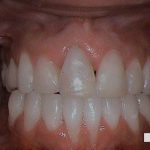 clean teeth dentist rockville