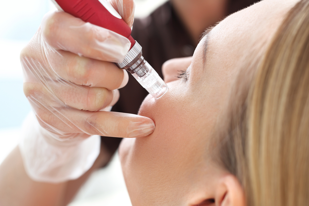 microneedling with PRP rockville