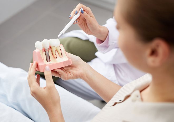dental crowns rockville