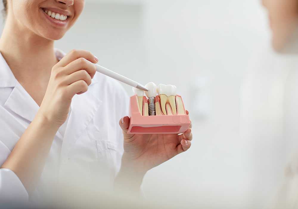 dental implants rockville