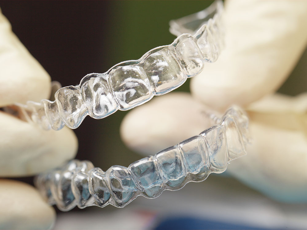 invisalign faq rockville
