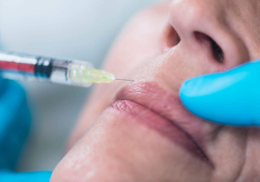 improve your smile botox potomac