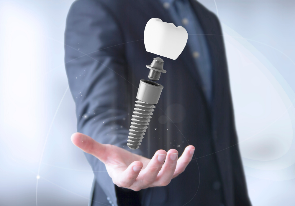 Dental Implants in Maryland