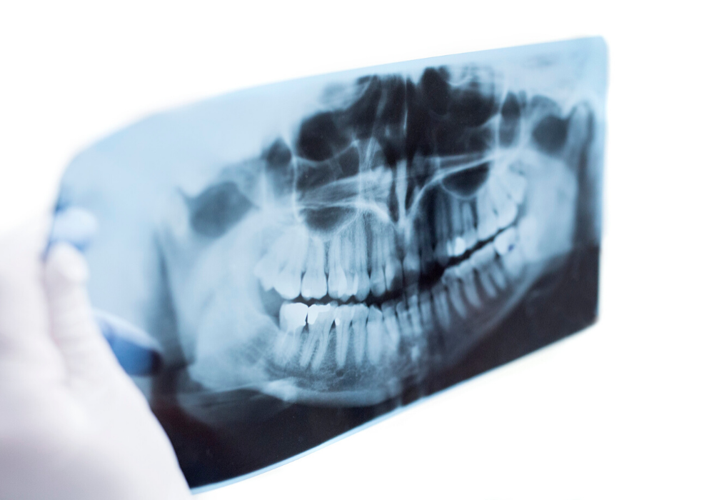 oral surgery in maryland