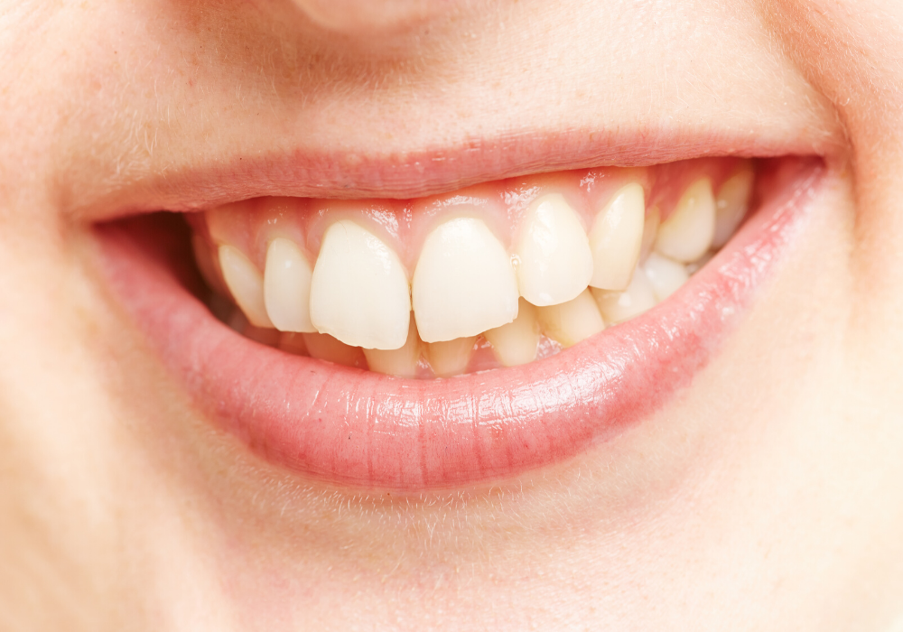 periodontitis dental services rockville