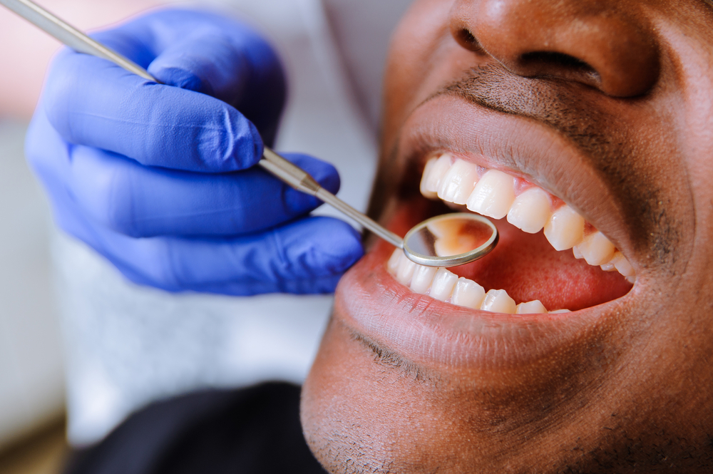 Why Is Regular Teeth Cleaning So Important?