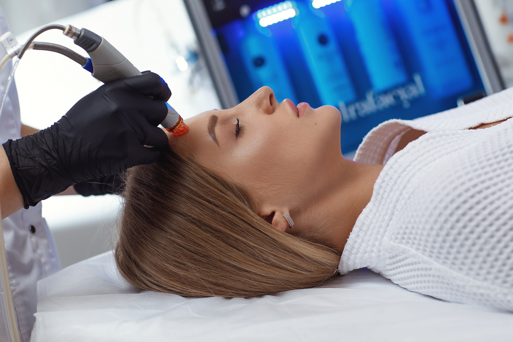 HydraFacial Work for Acne