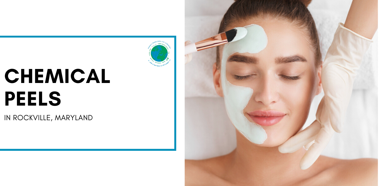 Chemical Peels Rockville Maryland