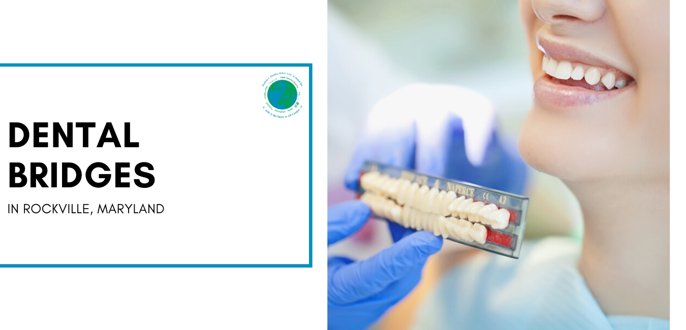 Dental Bridges in Rockville Maryland