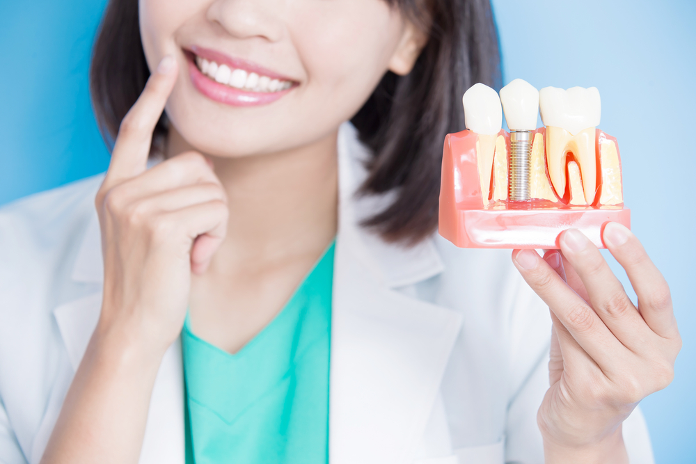 Best Dental Implants in Montgomery County