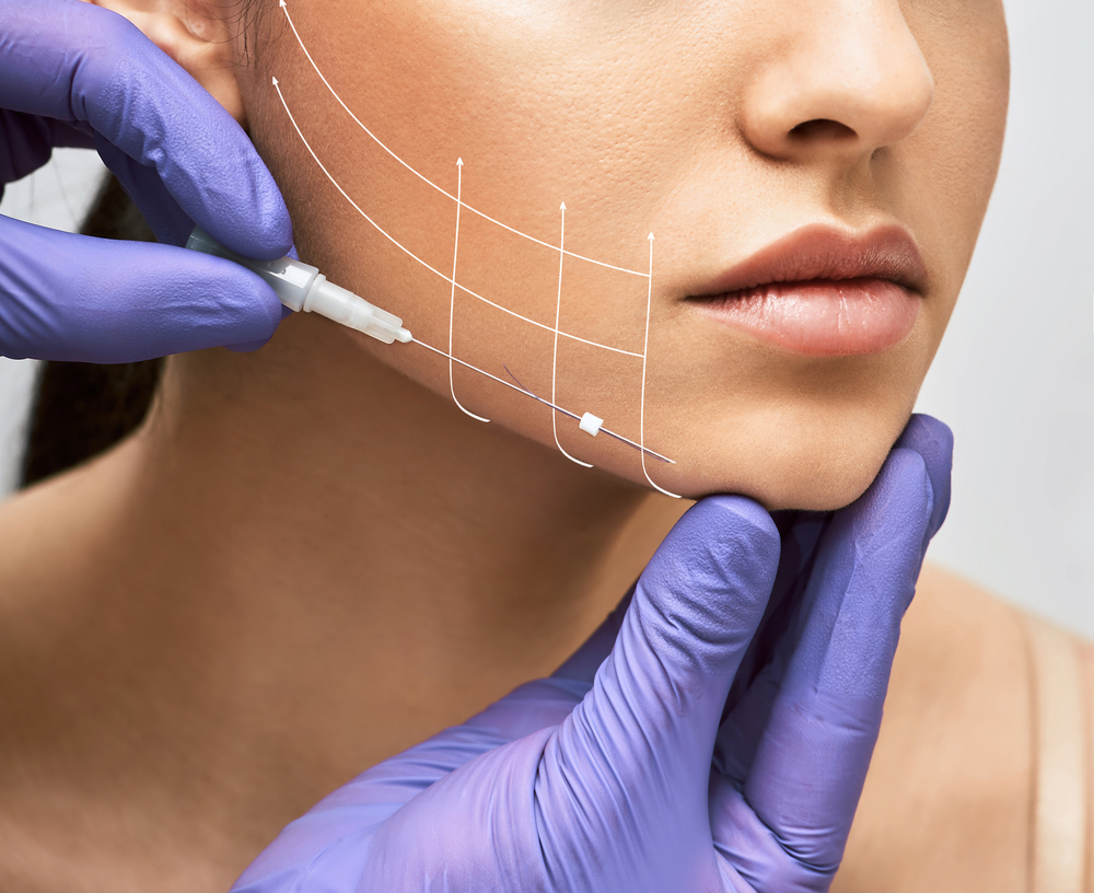 Thread Lift Rockville Maryland