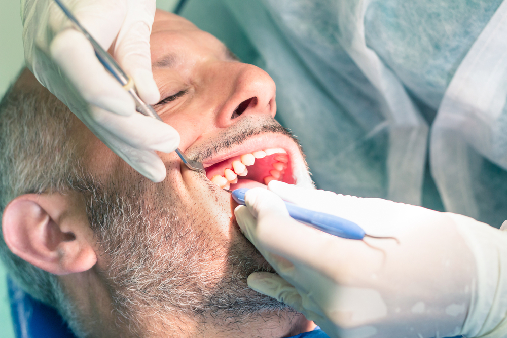 Does a Root Canal Hurt?