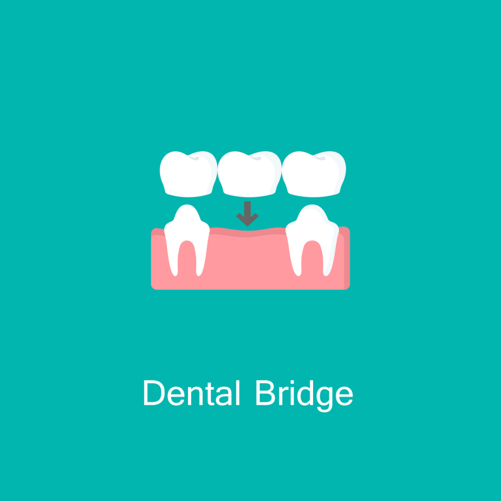 Dental Bridges in Rockville MD