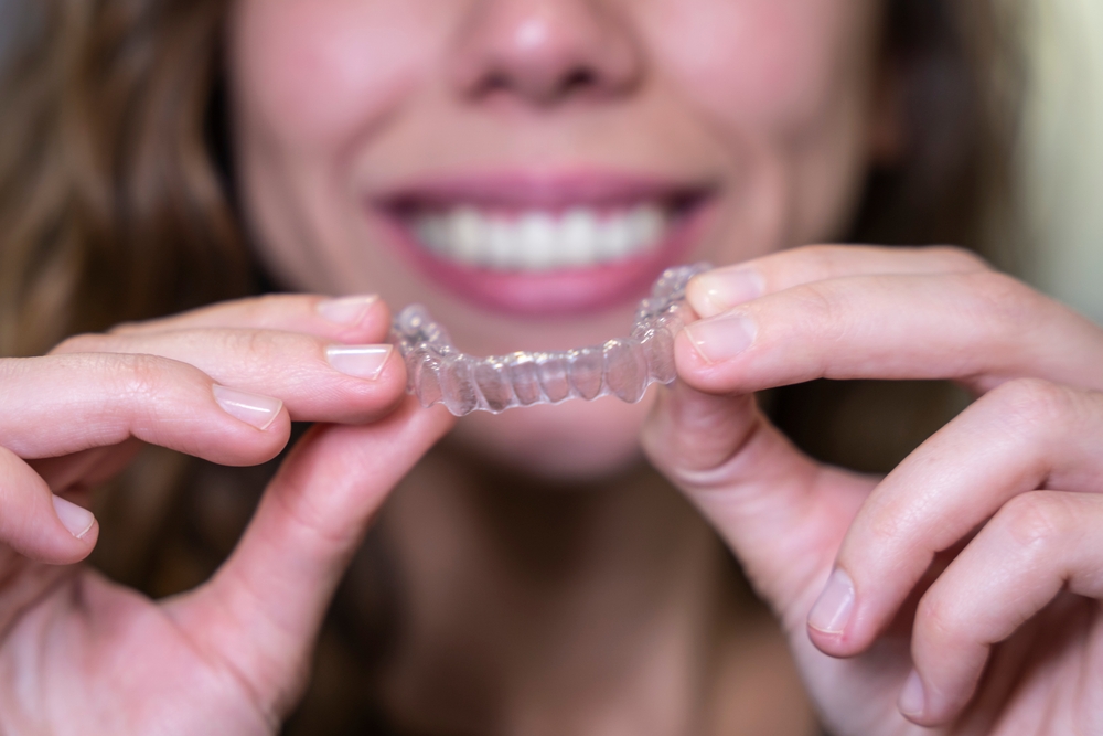 Invisalign Silver Spring