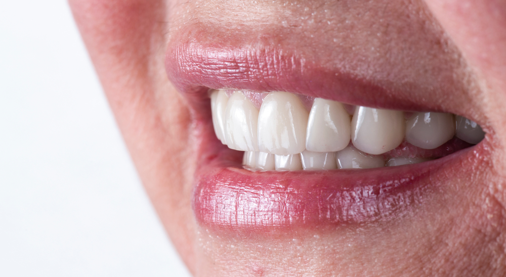 Dental Implant Pain Specialist in Rockville
