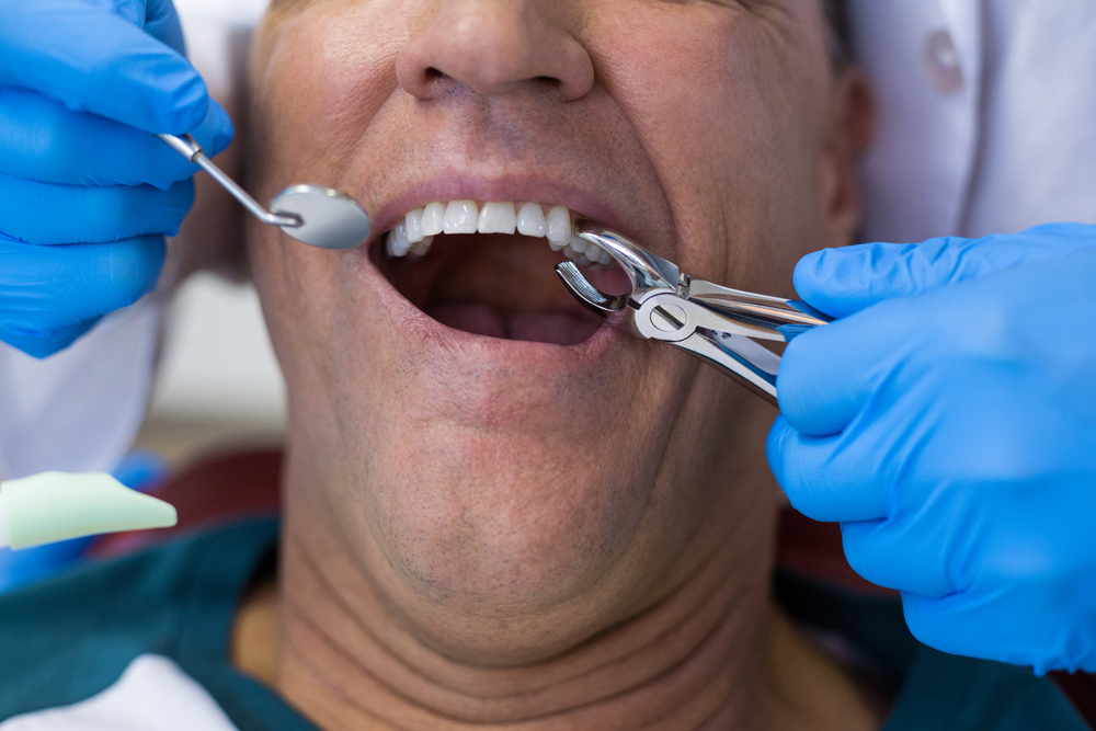 Can I Drink After Tooth Extraction