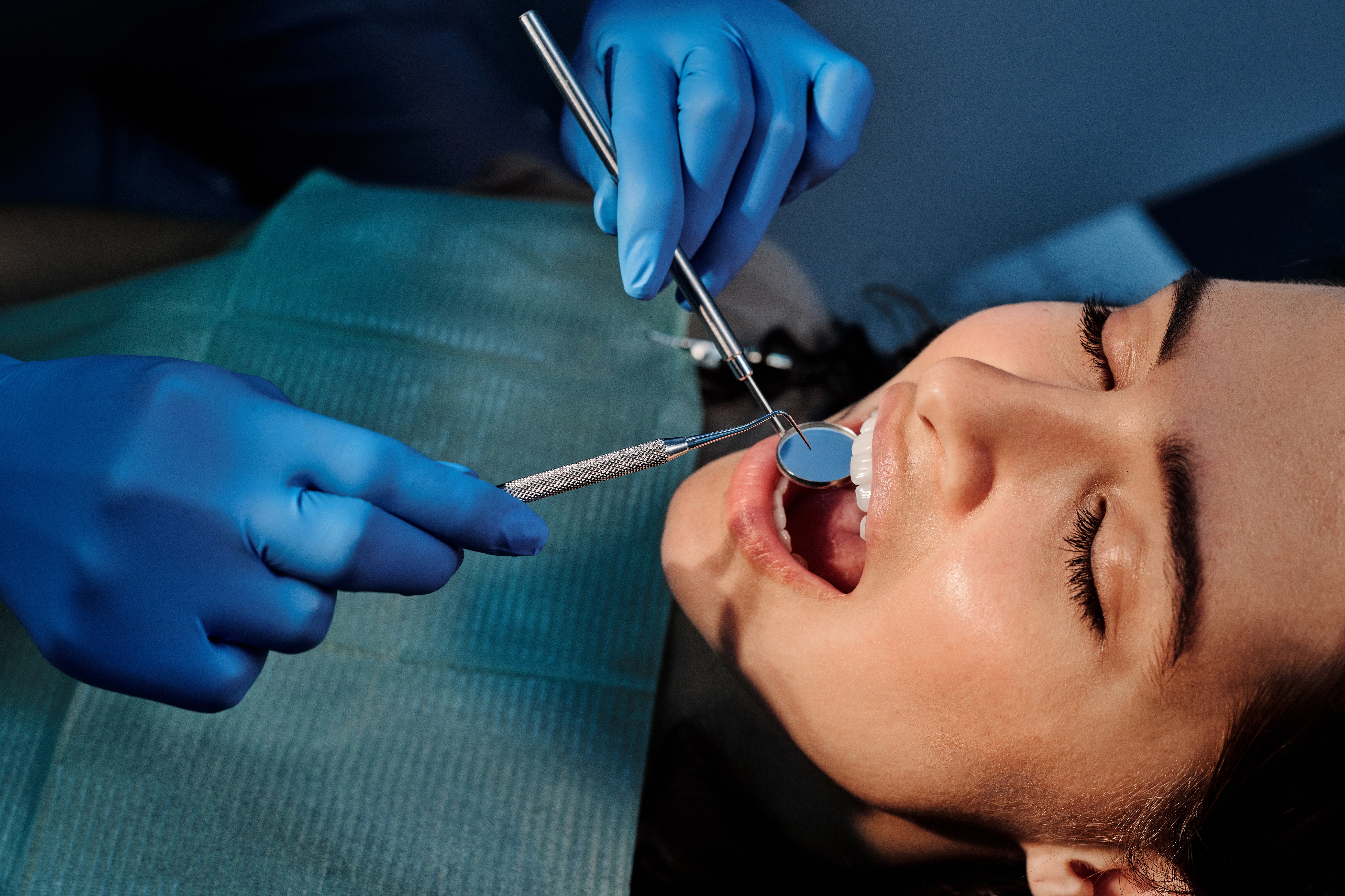 Should I Get Dental Implants Rockville, MD?