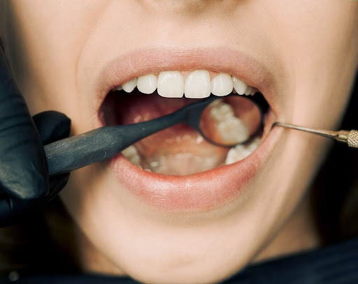 oral surgery rockville