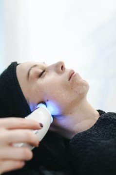 evoke facial treatment rovkville
